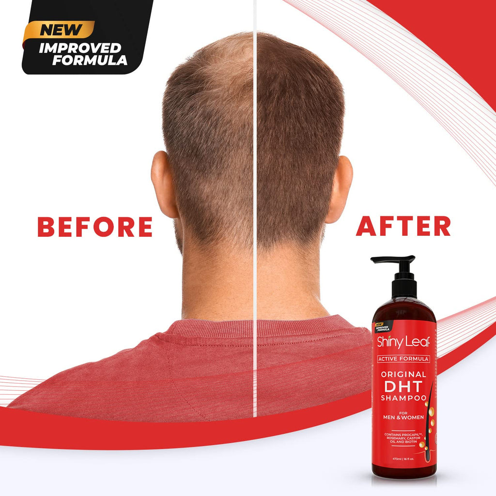 DHT Blocker Hair Loss Shampoo 16 oz, Active Formula For Hair Growth With Biotin